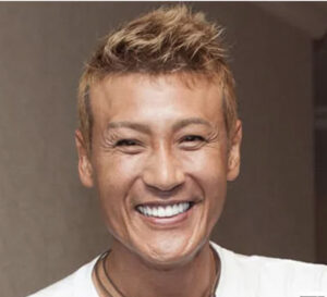 吉田正尚の歯が白すぎるのはホワイトニングではなくセラミック！噛みしめにも対応